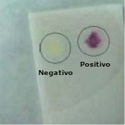 Prueba de la Oxidasa