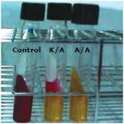 Reacciones bioquímicas en el agar TSI